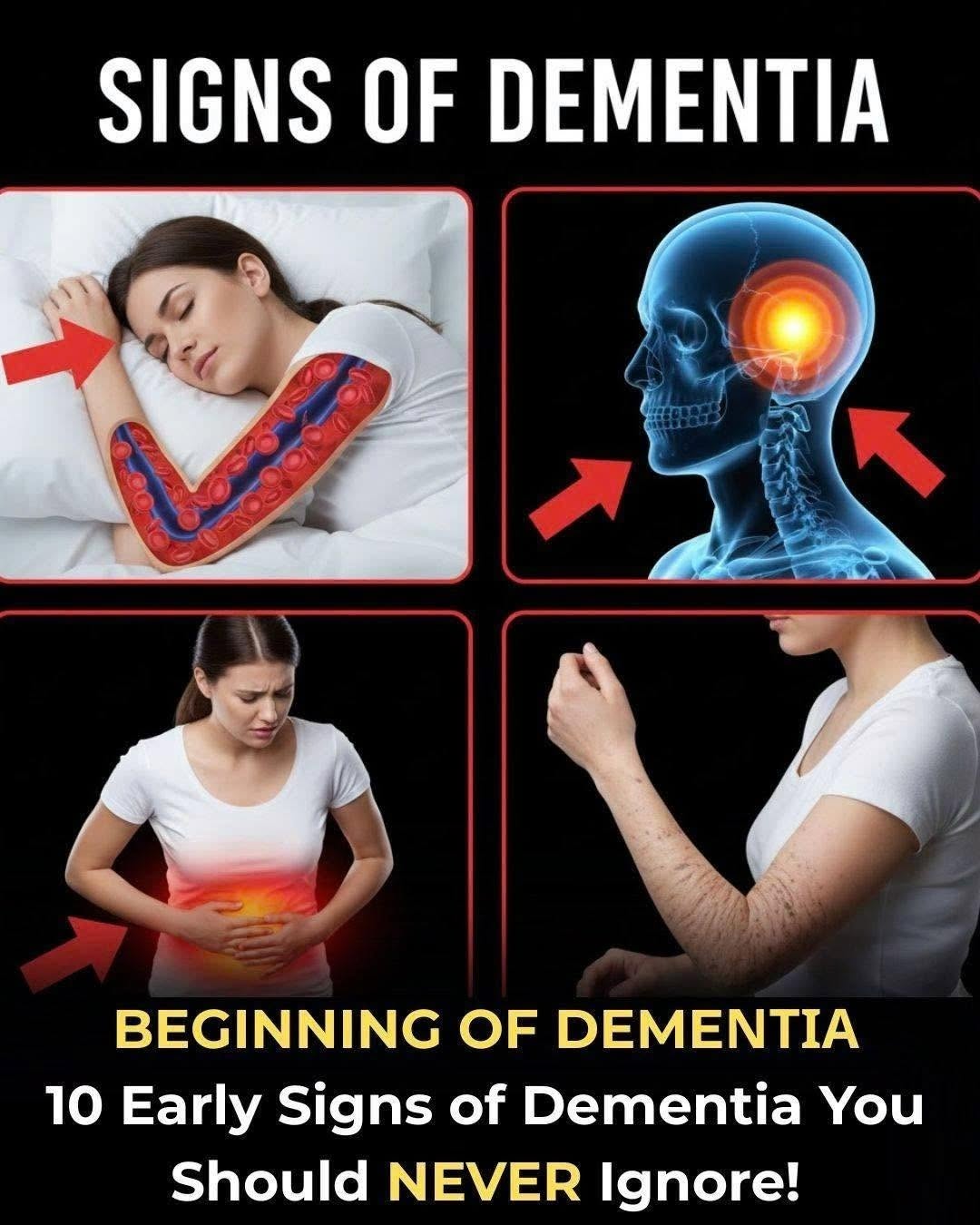 10 Early Signs of Dementia You Should NEVER Ignore