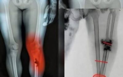 COVID-19 vaccinated individuals may be ill…See more