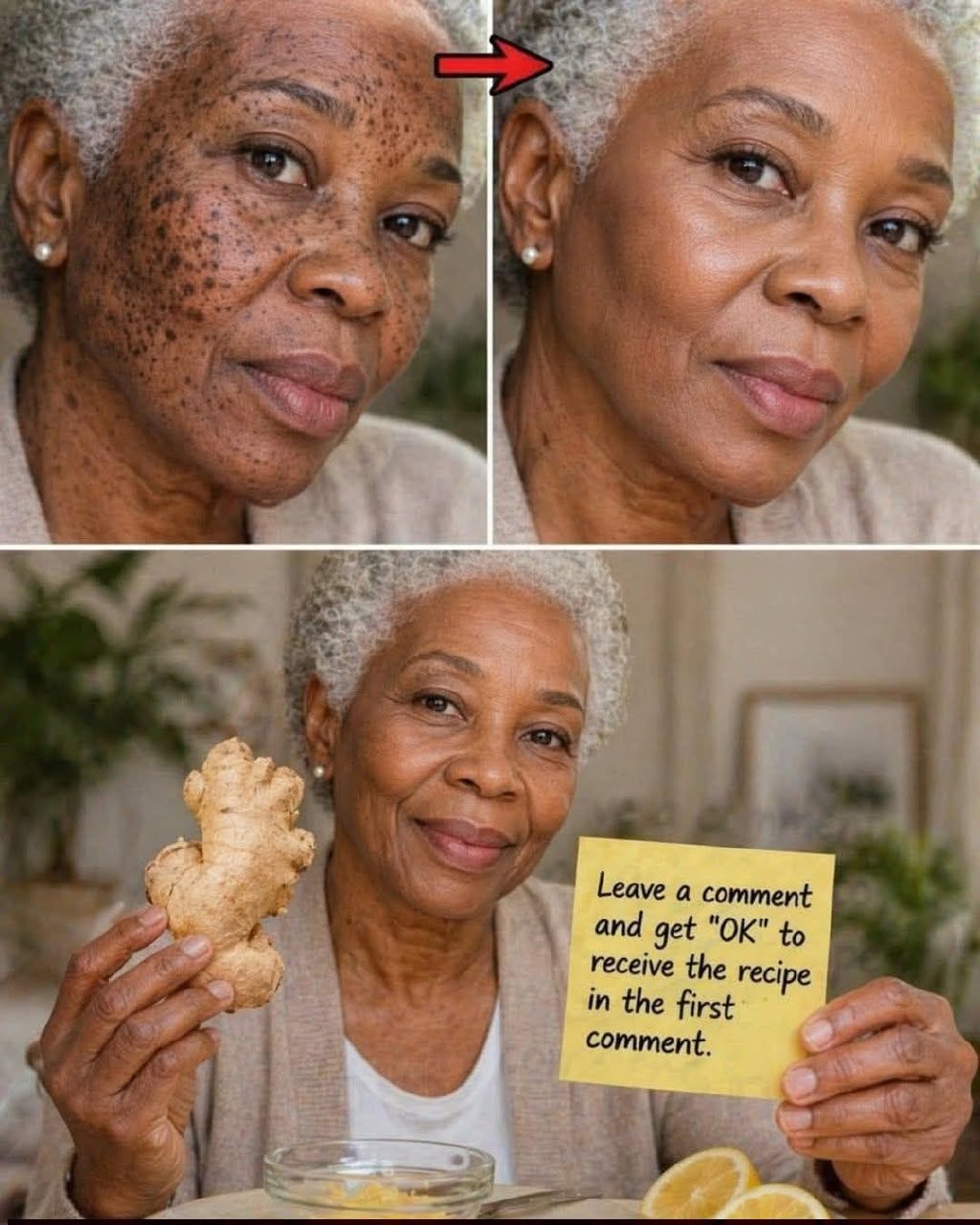 Potato and Ginger for Dark Spots: Can This Natural Remedy Really Transform Your Skin?