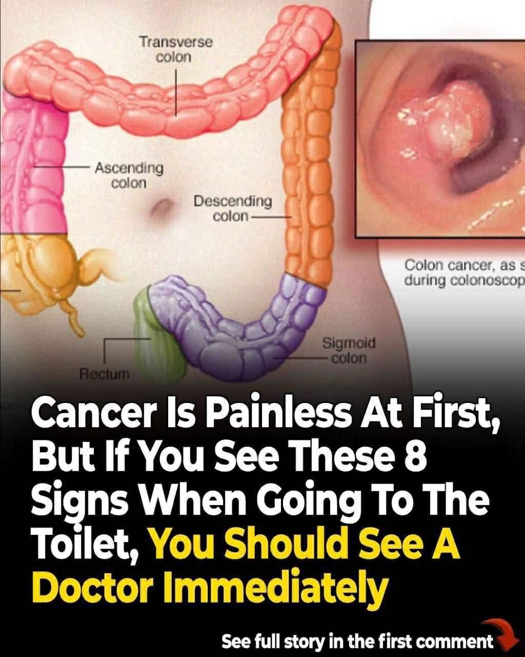 40+ Weird Signs That Lead To a Cancer Diagnosis
