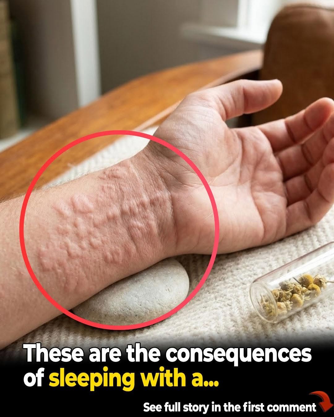 8 Surprising Hives Triggers You Might Be Overlooking