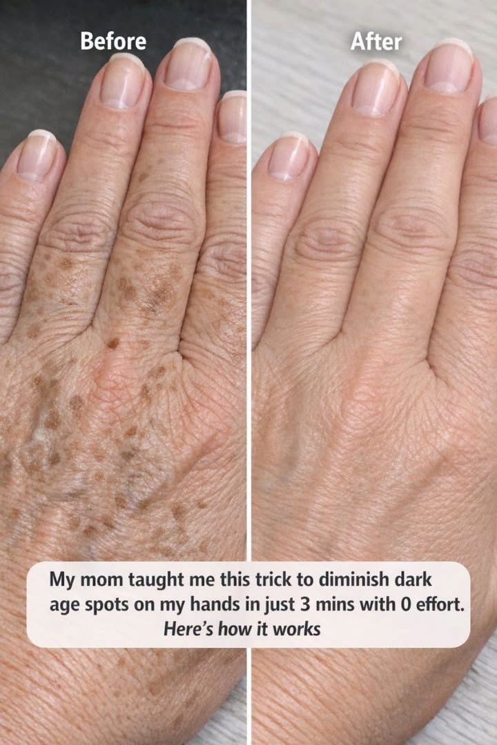 My mom taught me this trick to diminish dark age spots on my hands in just 3 mins with 0 effort. Here’s how it works