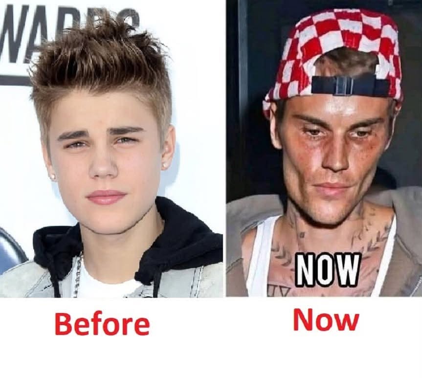 Justin Bieber admits that he tested positive for…𝗦𝗲𝗲 𝗺𝗼𝗿𝗲