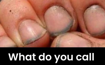 Dirty Nails: Neglect or a Sign of Hard Work?