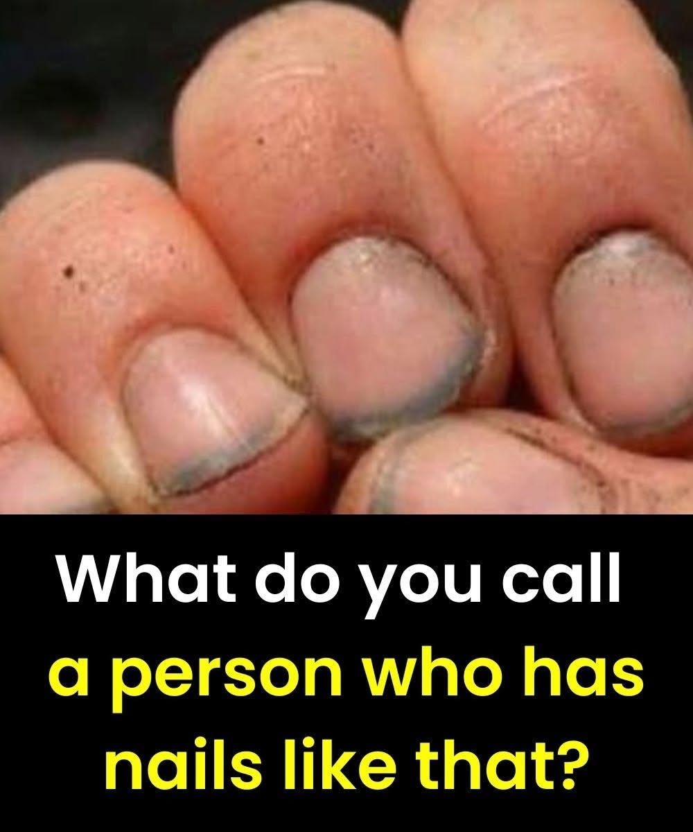 Dirty Nails: Neglect or a Sign of Hard Work?