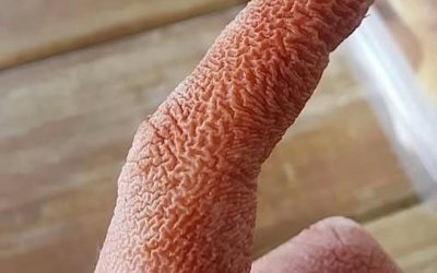 A shocking medical mystery is revealed: sudden and painful injuries to a woman’s face led to an unusual diagnosis that left doctors stunned.