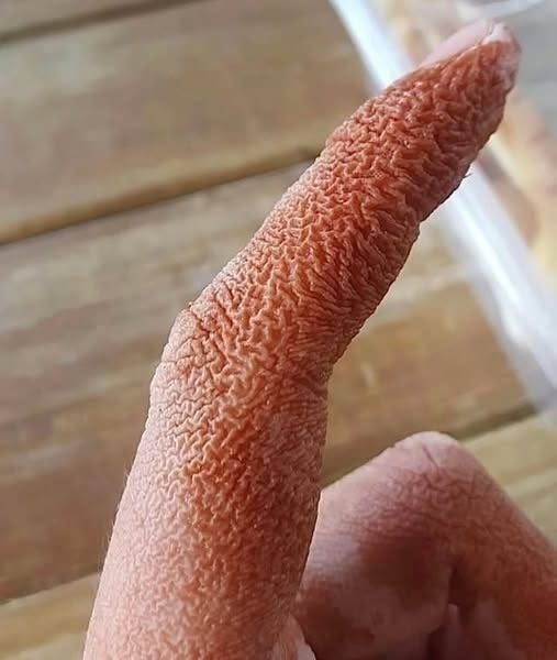 A shocking medical mystery is revealed: sudden and painful injuries to a woman’s face led to an unusual diagnosis that left doctors stunned.