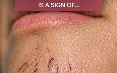 woman’s chin hair is a sign of