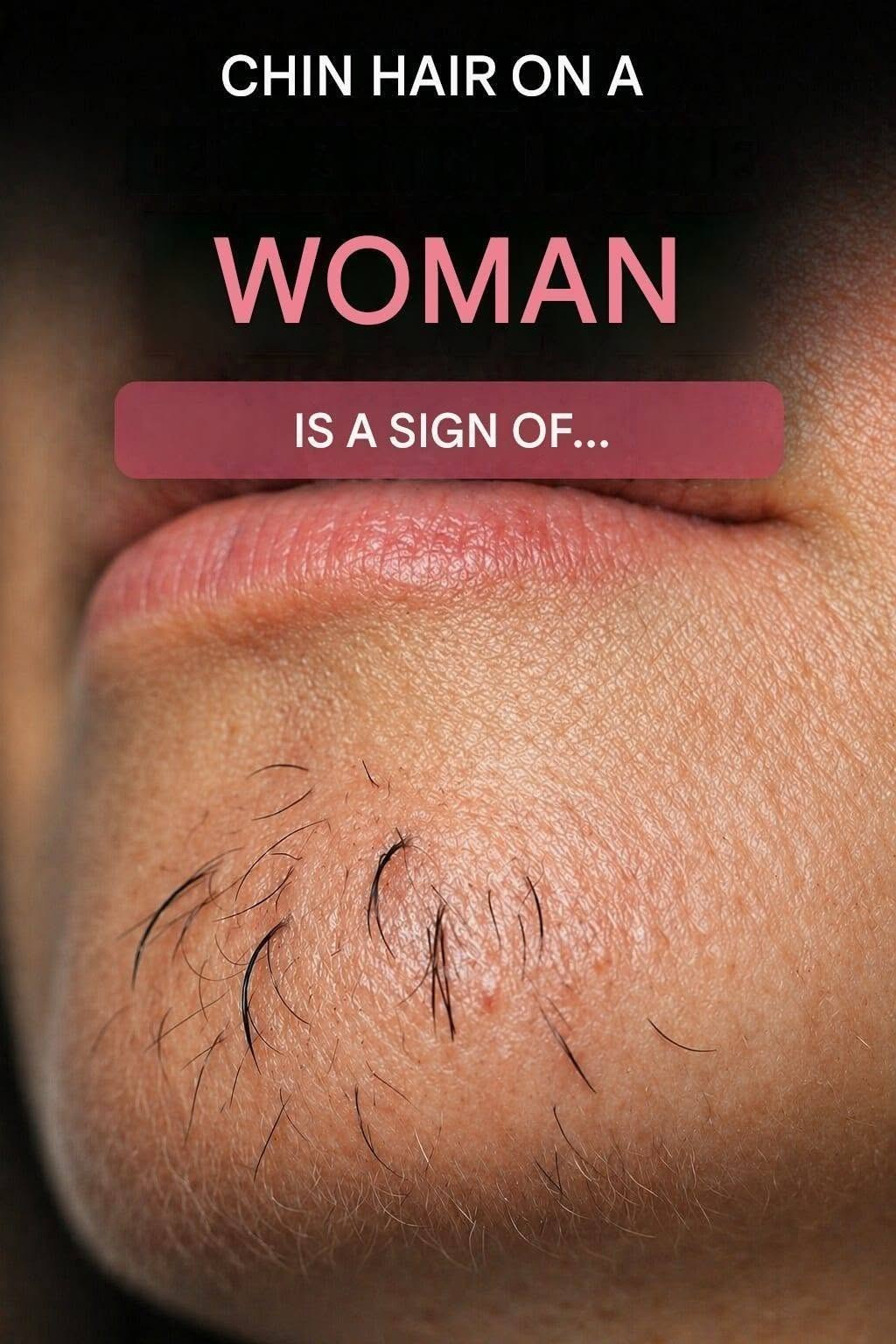woman’s chin hair is a sign of
