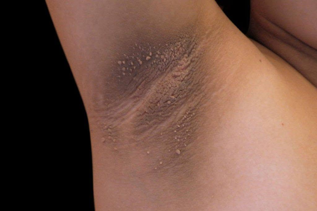 Search Results for: These are the first symptoms of cr…See more –
