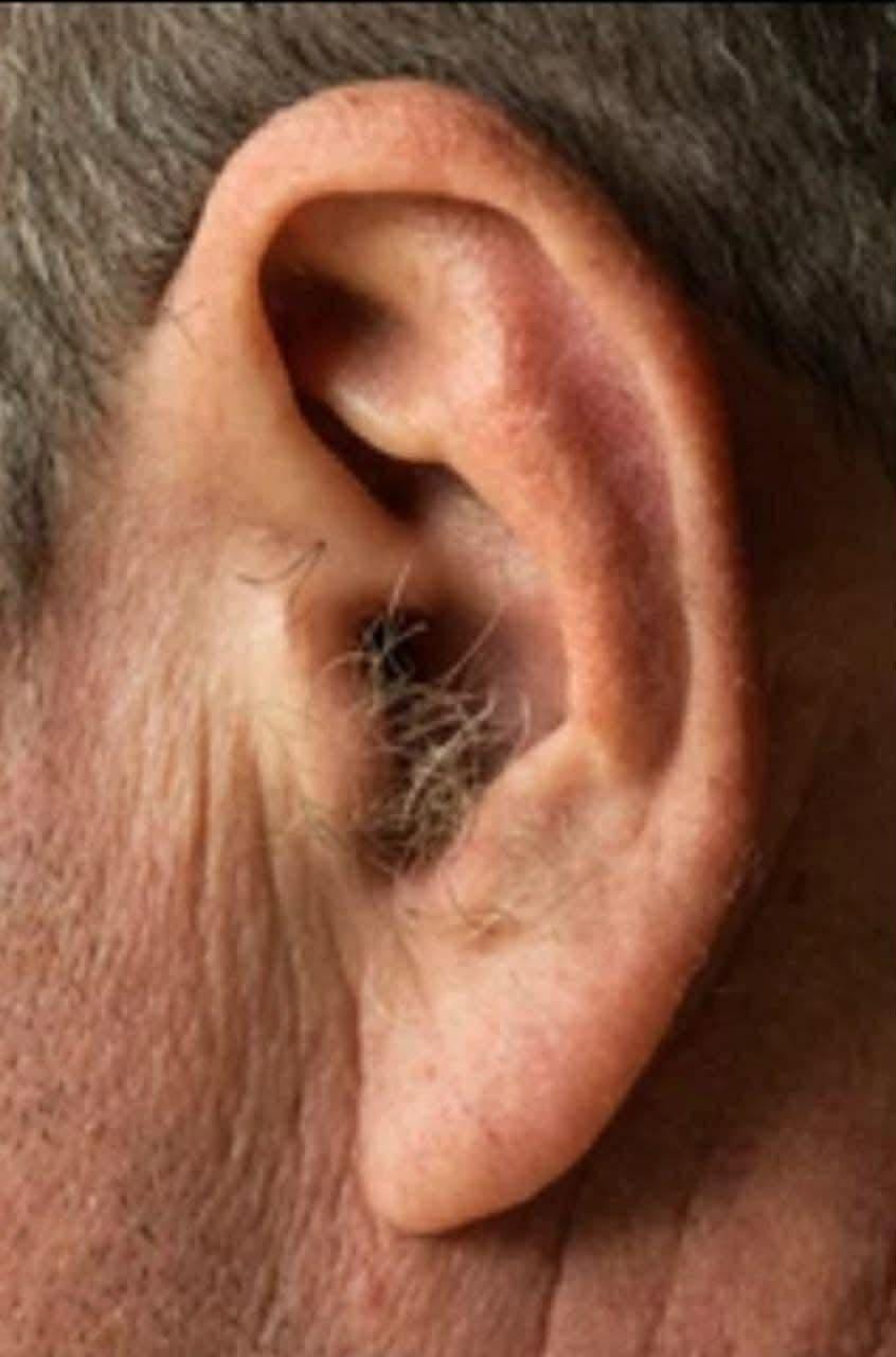Did you know that if your ear hairs grow, it is because your body is… See more