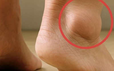 If you notice your legs are swollen, that’s a sign of ca…See more in 1st comment 👇👇
