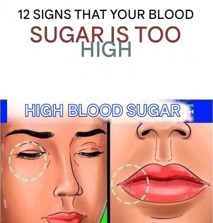 The High-Sugar Alert: Recognizing the 12 Key Symptoms Your Body is Showing You.