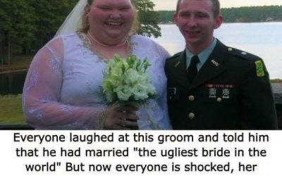 People called her ‘the ugliest bride in the world’