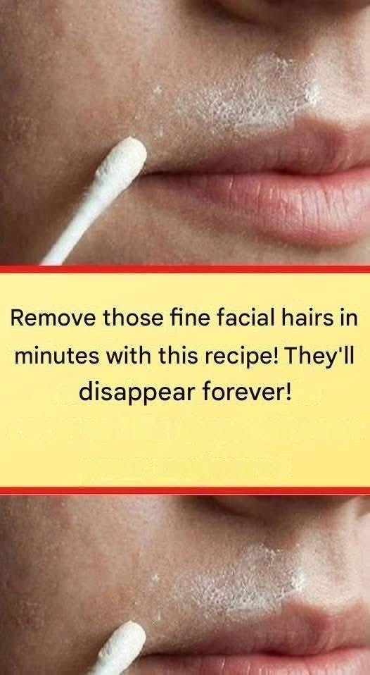 This natural recipe will permanently remove facial hair 1
