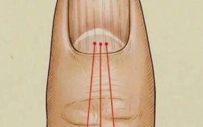 What to Eat to Reduce Nail Ridges: A Nutrition Guide for Healthier Nails