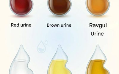 Urine Color Guide: What Different Shades May Mean