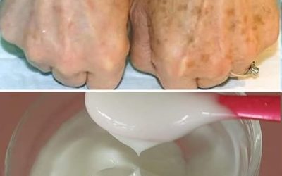 The Most Effective Cream Ingredients for Dark Spots and Signs of Skin Aging