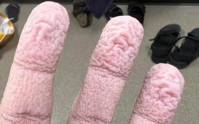 These are the consequences of using too m…see more