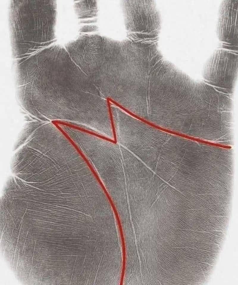 What the “M” on Your Palm Means
