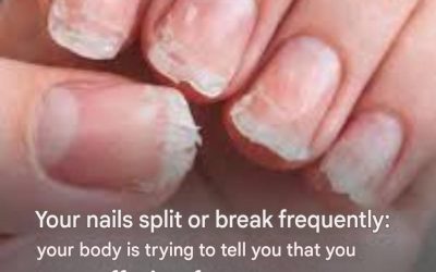 Your nails are breaking or splitting: this detail reveals a problem