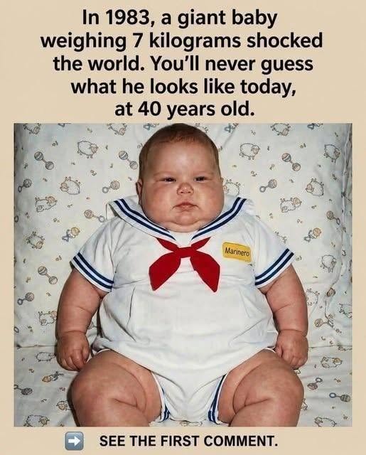 The 7 kilo baby who amazed the world in 1983: this is how it looks today, at the age of 40.1