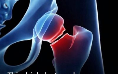The five drinks that are most harmful to your bones, according to health experts.