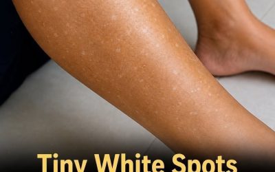 Tiny White Spots on Your Arms or Legs? Here’s What They Could Be Telling You