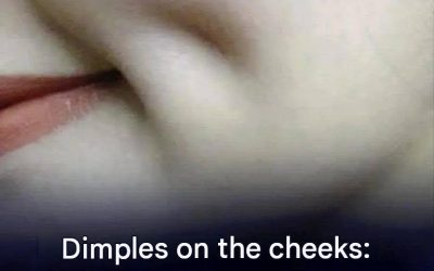 The mystery of dimples: where do these charming features come from?
