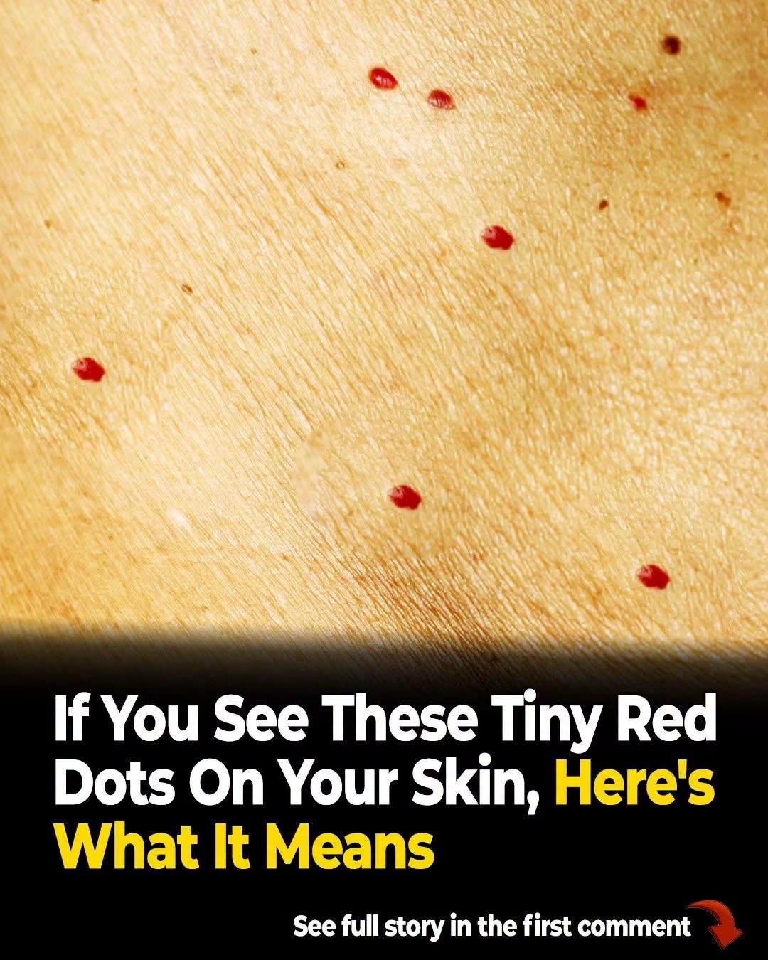 Red dots on your skin: Causes and what they could mean