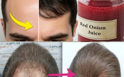 I’m shocked! With the help of this ingredient, the hair on my bald spot is growing like crazy! Must express something to keep getting my recipes…. Thank you Recipe in (c.o.m.m.e.n.t ).…