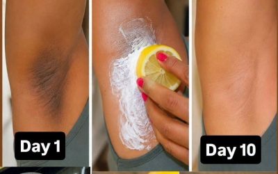 6 Home Remedies to Lighten Dark Underarms | How to get rid of Dark Underarms