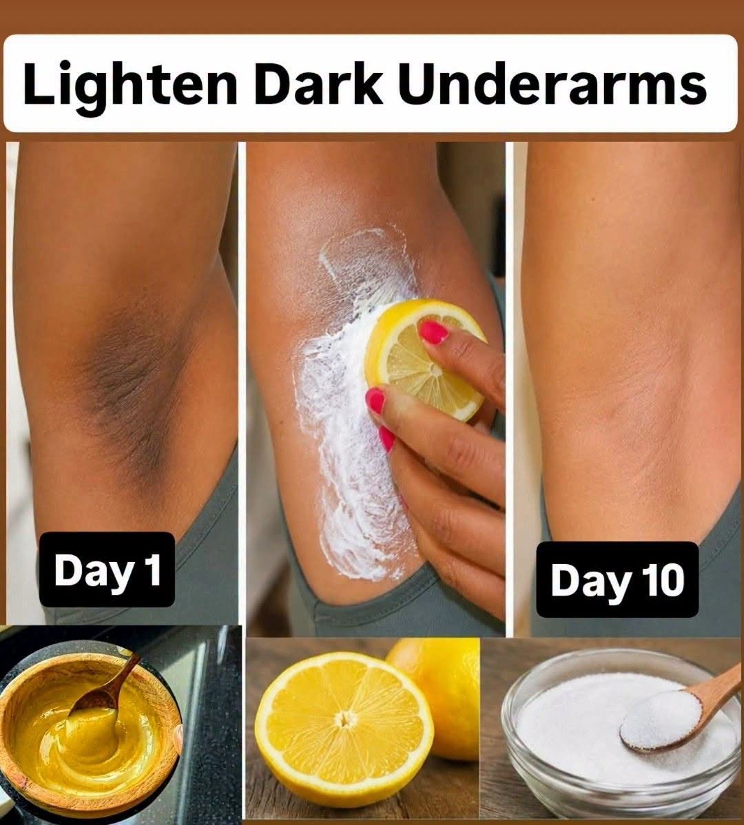 6 Home Remedies to Lighten Dark Underarms | How to get rid of Dark Underarms