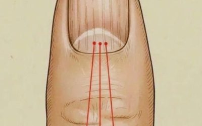 What to Eat to Reduce Nail Ridges: A Nutrition Guide for Healthier Nails
