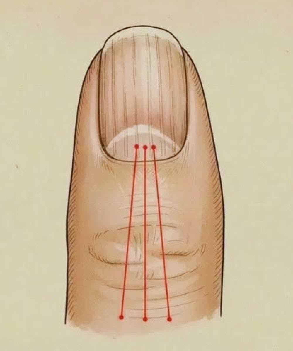 What to Eat to Reduce Nail Ridges: A Nutrition Guide for Healthier Nails