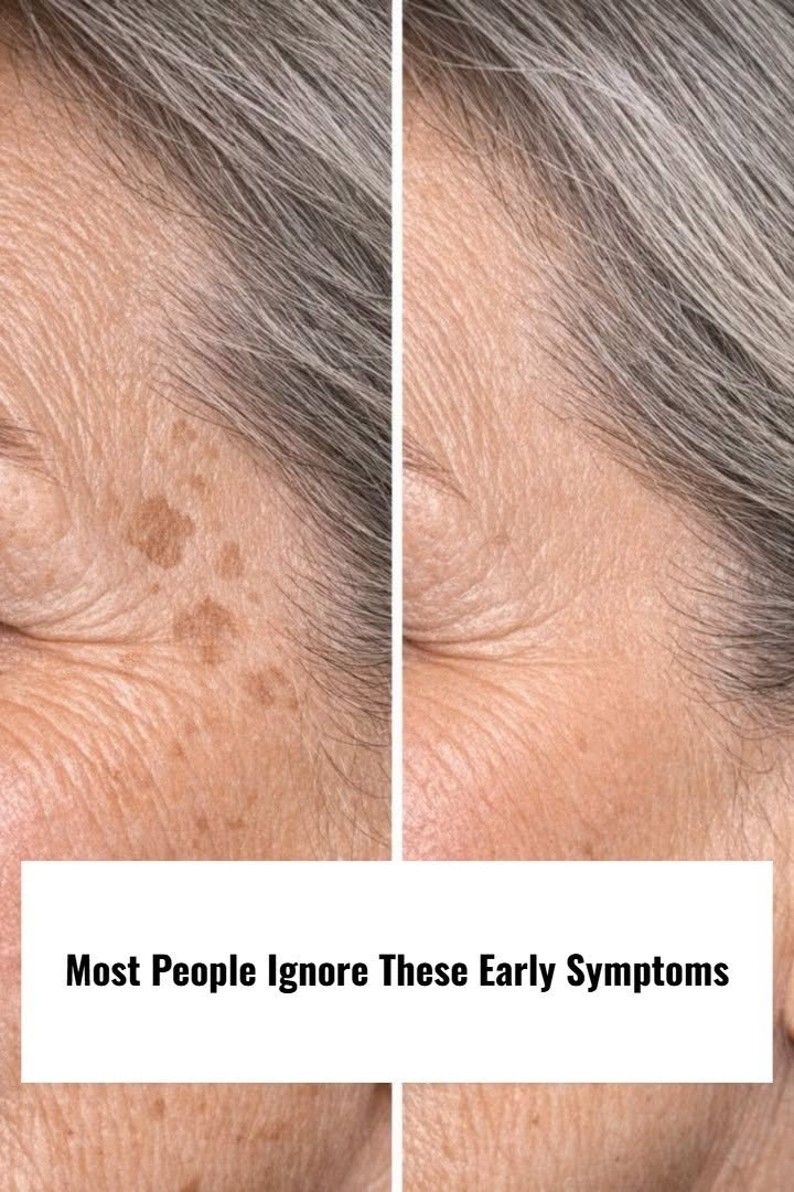 Most People Ignore These Early Symptoms